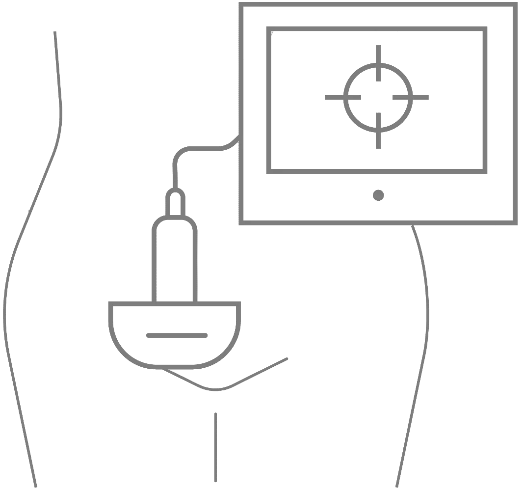 Ultrasound Pelvis